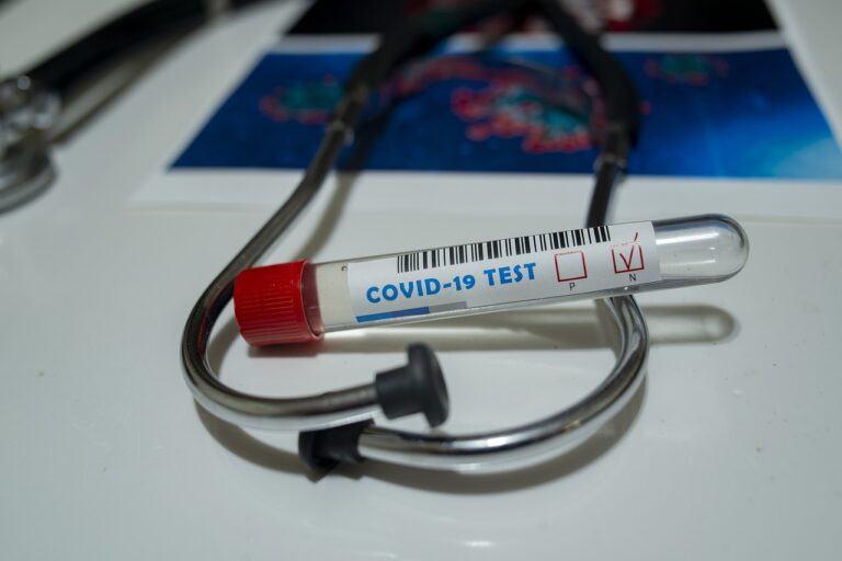 Test sierologici per il Covid-19 a richiesta all'ospedale Parini