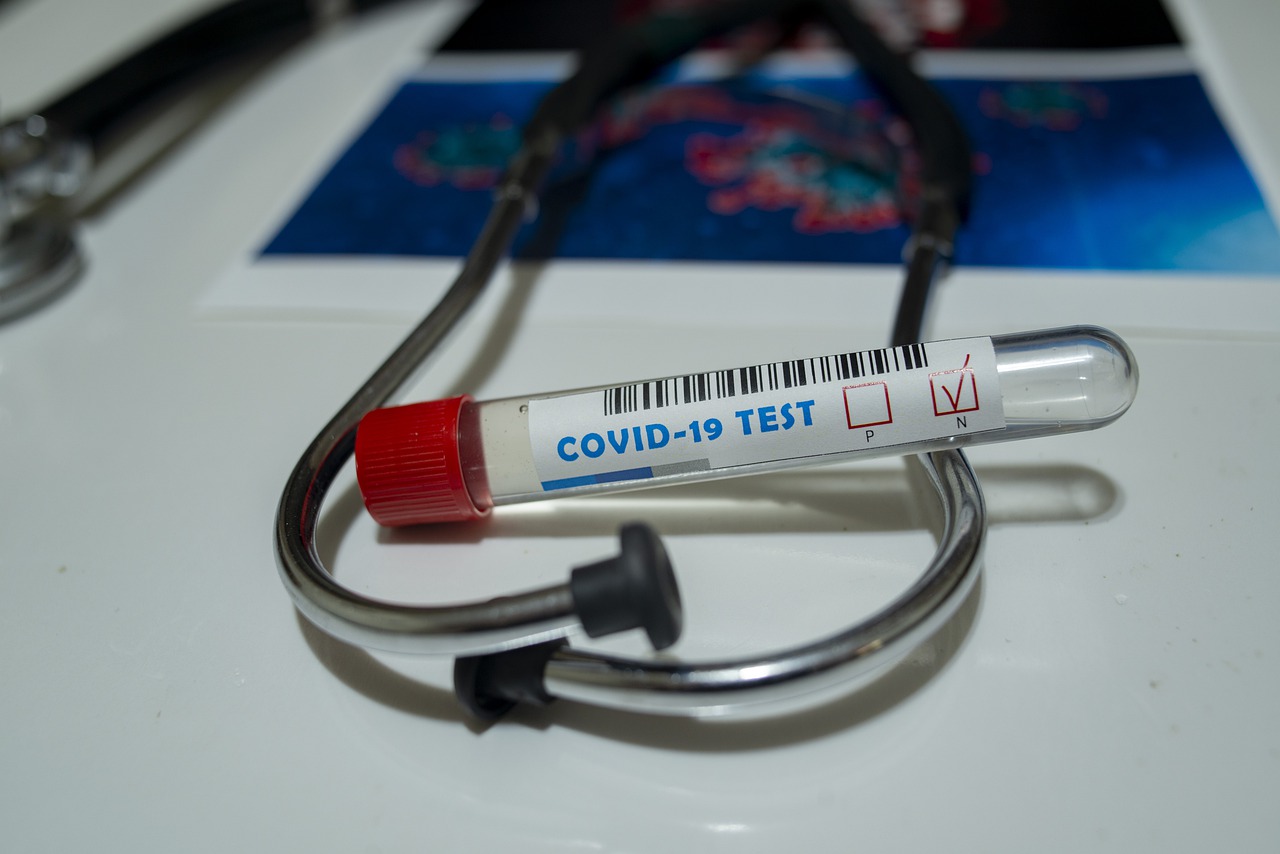 Test sierologici per il Covid-19 a richiesta all\'ospedale Parini
