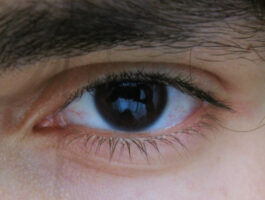 Occhio agli occhi: prevenire le maculopatie