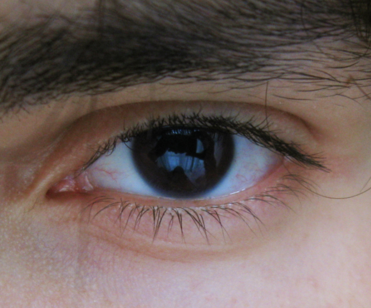 Occhio agli occhi: prevenire le maculopatie