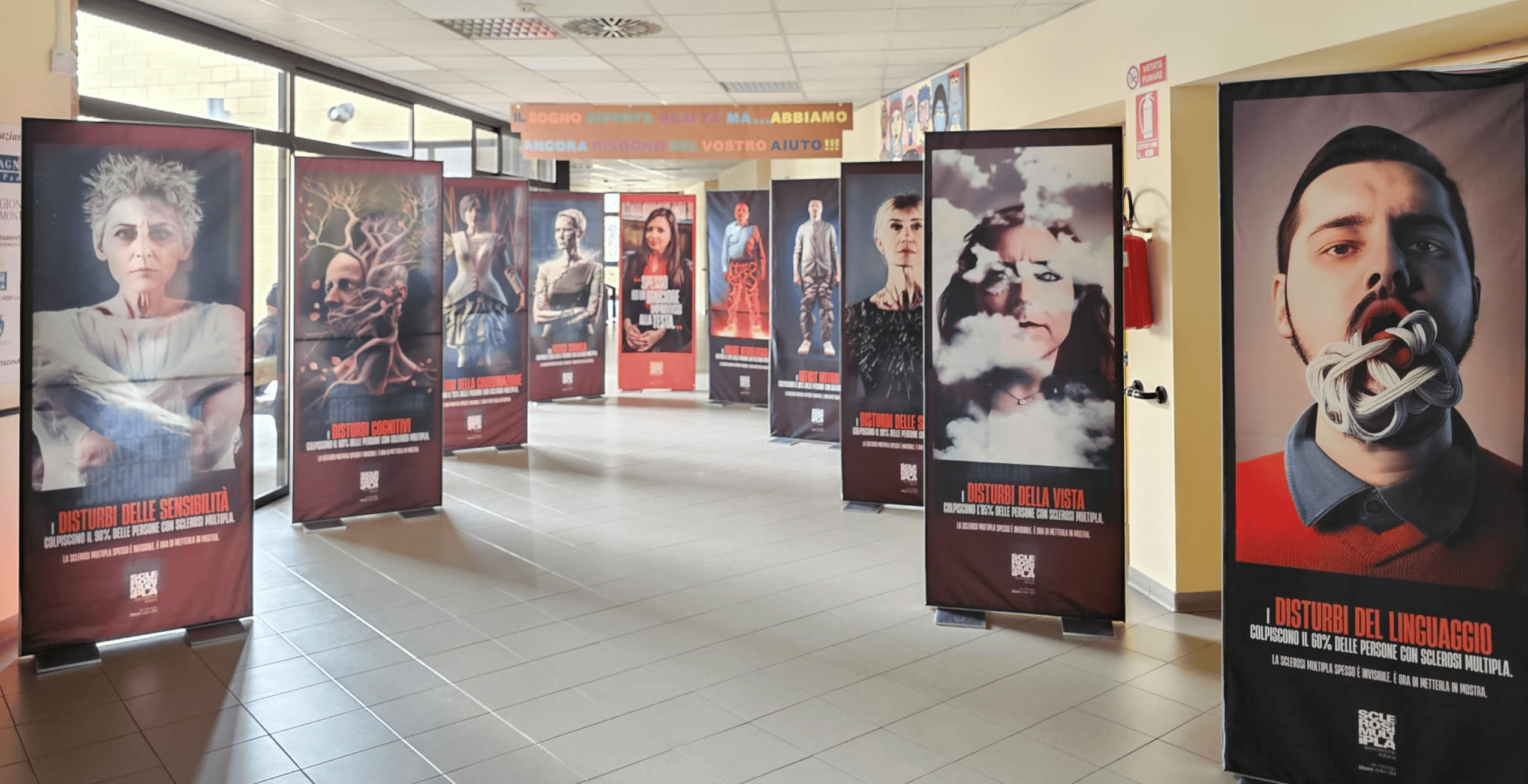 Aism VdA: una mostra per dare visibilità alla sclerosi multipla